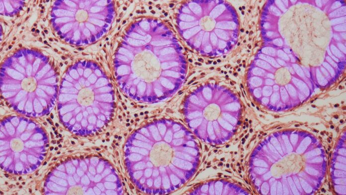 d6194942-fcf9-4975-ac28-8f51b3434f7c