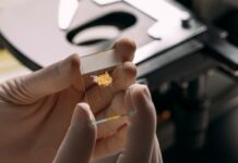 Новий пухлинний вузлик, покритий кісткою, класифікується як доброякісний, що дозволяє уникнути непотрібного лікування раку