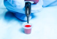 Татуювання, що викликало некроз: рідкісна імунна відповідь на чорнило для татуювань