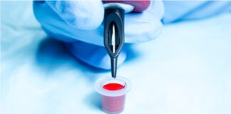 Татуювання, що викликало некроз: рідкісна імунна відповідь на чорнило для татуювань