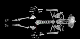 Croissance accélérée : comment les Néandertaliens se sont adaptés à un monde difficile