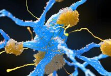 Les médicaments amaigrissants pourraient-ils protéger contre la maladie d’Alzheimer ? Une nouvelle revue explore le lien